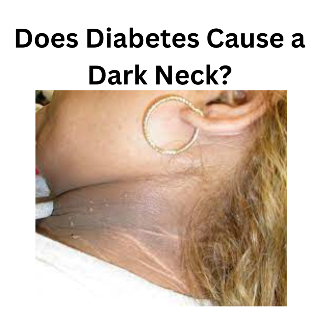 does diabetes cause a dark neck